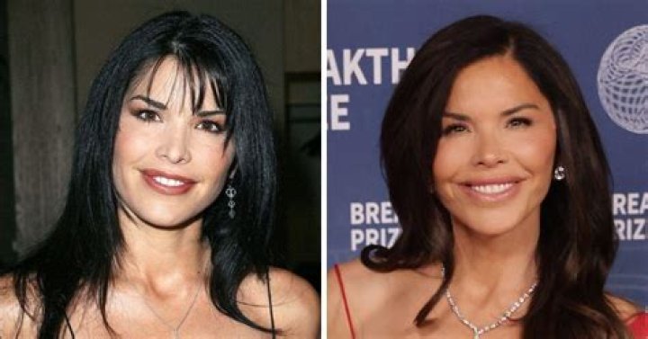 Bridget Moynahan Plastic Surgery Before and After