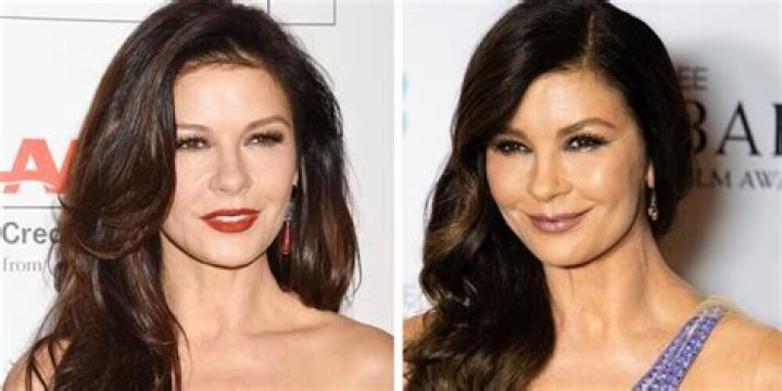 Catherine Zeta Jones Breast Implants Plastic Surgery Before and After