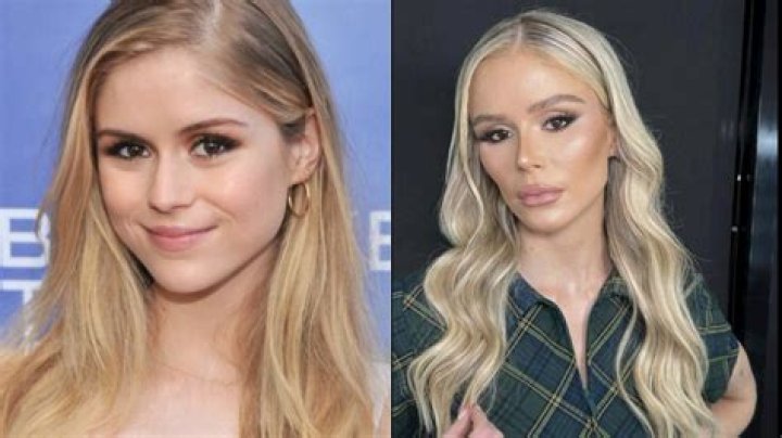 Gracie Hunt Plastic Surgery: The Buzz Behind the Miss Kansas USA's Transformations