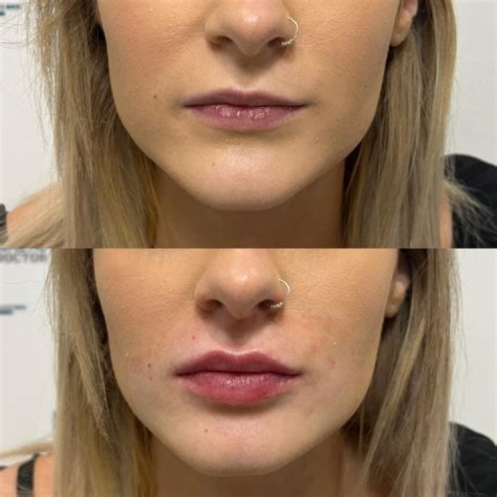 Kamilla Kowal Plastic Surgery: Suspected of Undergoing Nose Job and Lip Fillers?