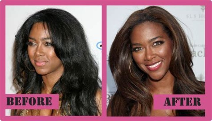 Kenya Moore Buttock Implants Plastic Surgery Before and After