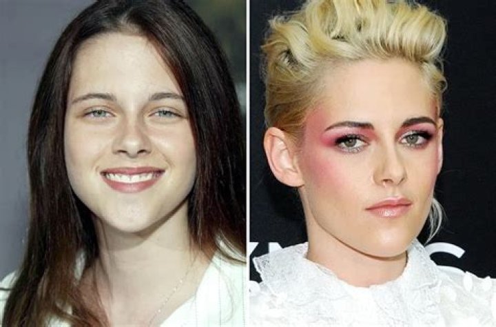 Kristen Stewart Nose Job Plastic Surgery Before and After