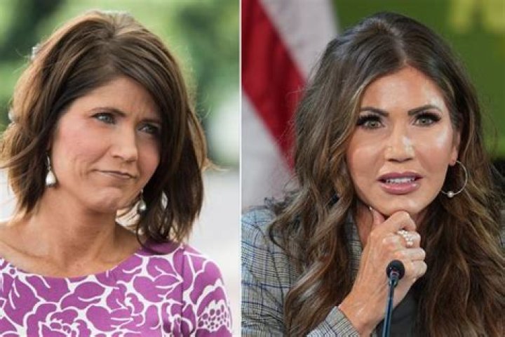 Kristi Noem Plastic Surgery: What Are Some Possible Procedures?