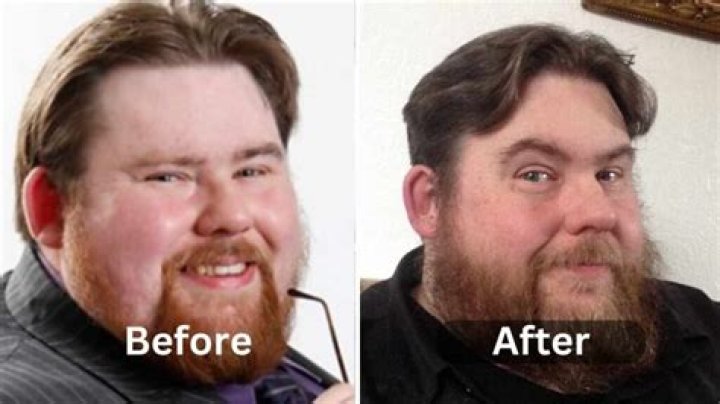 Michael Baggott Weight Loss: Are These Rumors True Or Not?