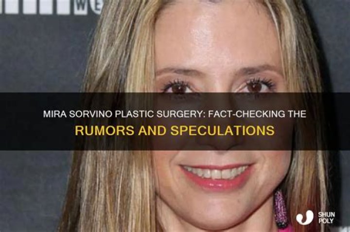 mira sorvino plastic surgery: Is it rumor or real?