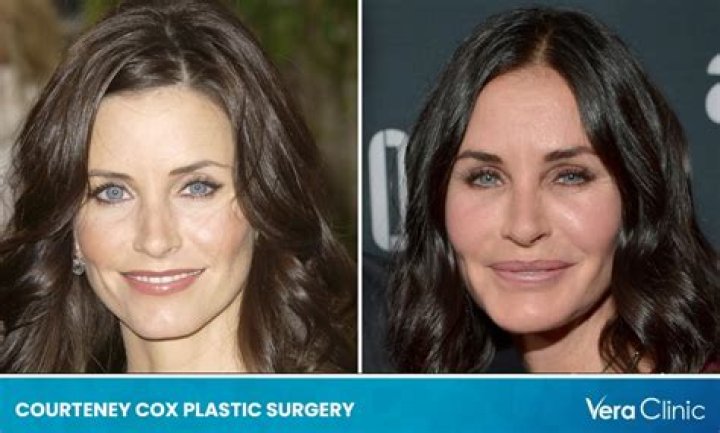 Pictures of Courtney Boerner Before Surgery