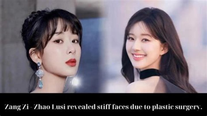 Zhao Lusi Plastic Surgery: What Alterations Has She Made?
